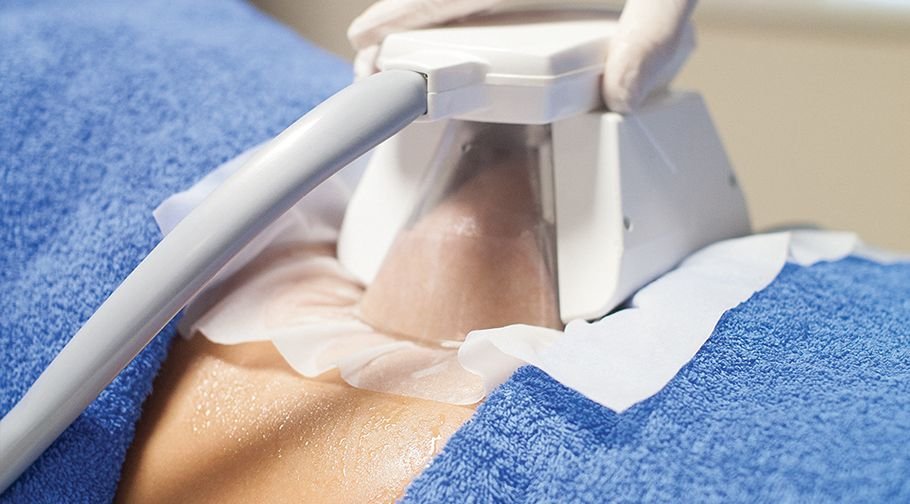 Cryolipolysis (Freezing Machine)