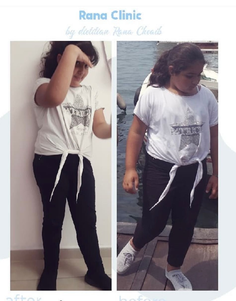Client transformation after personalized nutrition plan at Kareem Clinic, Nabatieh